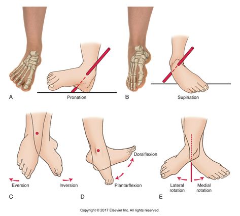 Decreased Ankle Dorsiflexion is Associated with Dynamic Knee Valgus Genu Valgum, Ankle Dorsiflexion, Genu Varum, Achilles Tendinopathy, Muscle Diagram, My Knee Hurts, Foot Anatomy, Body Pain Relief, Basic Anatomy And Physiology