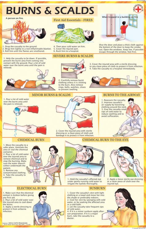 First Aid Charts Exporter, Manufacturer, Distributor & Supplier, First Aid Charts India First Aid For Burns, First Aid Tips, Emergency First Aid, Severe Burns, Survival Life Hacks, Survival Life, Emergency Prepping, Medical Knowledge, Medical Education