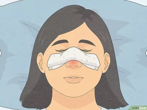 A quick guide to fast relief for blocked sinuses Your sinuses are an extensive network of passageways near your nose. Clear sinuses make for easy breathing, but sinuses blocked by mucus can make for quite a bit of discomfort that might... Sinus Headache Remedies, Drain Sinuses, Sinus Pressure Relief, Remedy For Sinus Congestion, Congestion Remedies, Blocked Sinuses, Sinus Drainage, Sinus Remedies, Home Remedies For Sinus