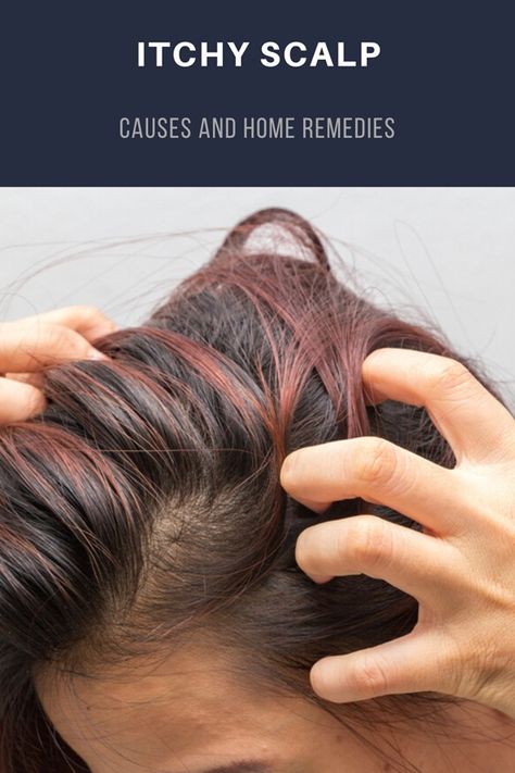 Remedies For Itchy Scalp, Itchy Scalp Causes, Remedies For Dry Mouth, Home Remedies For Warts, Oily Skin Remedy, Warts Remedy, Natural Remedies For Migraines, Coconut Oil Hair Mask, Itching Skin