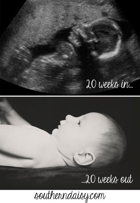 20 Weeks Old! | Southern Daisy 20 Week Ultrasound, Foods To Avoid During Pregnancy, 20 Weeks, Newborn Baby Photos, Baby Boy Photos, Foto Baby, Older Brother, Atticus, Foods To Avoid