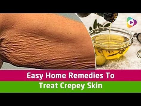 Crepy Skin, Crepe Skin, Creepy Skin, Crepey Skin, Combination Skin Type, Skin Care Wrinkles, Oily Skin Care, Homemade Face, Skin Remedies