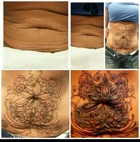 Stomach Tattoos To Cover Loose Skin, Tattoos Stomach, Tattoo Makeup Coverup, Scars Tattoo, Stretch Mark Tattoo, Button Tattoo, Stomach Tattoo, Waist Tattoos, Yoga Photoshoot