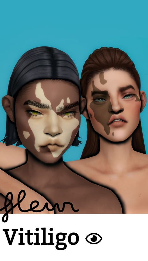 Maxis Match CC World - S4CC Finds, FREE downloads for The Sims 4 The Sims 4 Skin, Pelo Sims, Sims 4 Mm Cc, Sims 4 Cc Skin, Sims 4 Body Mods, Tumblr Sims 4, Sims 4 Cc Folder, Sims 4 Characters, Sims 4 Mm