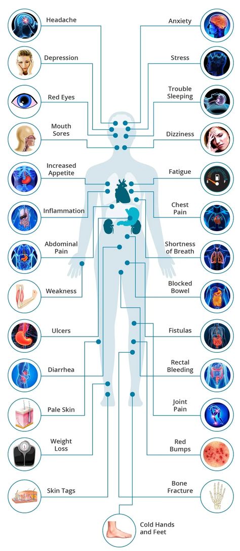 What are the Effects of Crohns Disease on the Body? Chrones Disease, Crohns Symptoms, Crohns Diet, Chrons Disease, Digestive Tract, Disease Symptoms, Autoimmune Disorder, Brain Fog, The Human Body