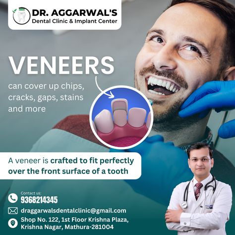 Dental Post, Dental Posts, Ad Ideas, Dental Veneers, Creative Ads, Your Smile, Ads Creative, Marketing Ideas, Dental Implants