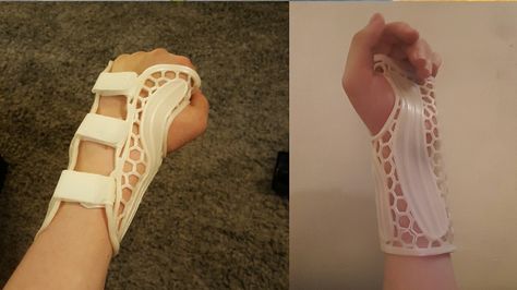 How to 3D Print a Lightweight Wrist Brace | All3DP Diy Wrist Brace, How To 3d Print, Arm Wear, 3d Printing Fashion, Wrist Brace, 3d Printer Projects, 3d Printed Objects, Medical Design, 3d Fashion