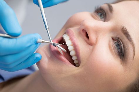 The Truth about Dental Cleaning - Glendale Dentist Dental Crown Procedure, Dental Photos, Lost Tooth, Implant Dentistry, Emergency Dentist, Metal Post, Missing Teeth, Dental Cleaning, Dental Crowns