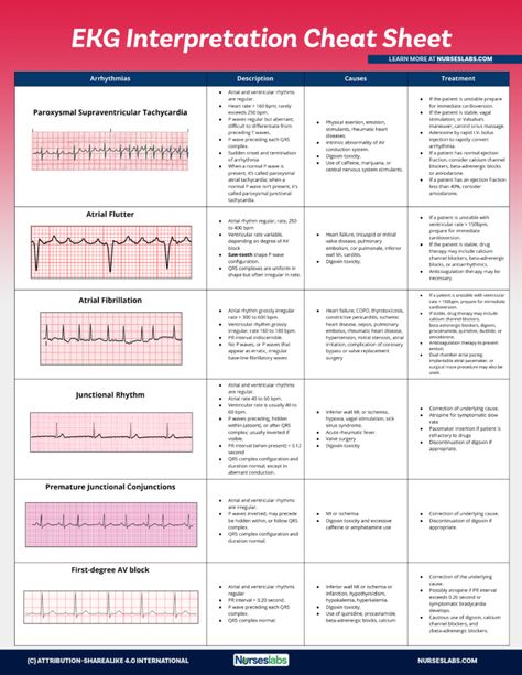 EKG Interpretation Cheat Sheet & Heart Arrhythmias Guide (2020 Update) Heart Rhythms Nursing, Arrhythmias Nursing Cheat Sheets, Paramedic Cheat Sheet, Nremt Study Cheat Sheets, Ekg Rhythms Cheat Sheets, Ekg Cheat Sheet, Easy Ekg Interpretation Cheat Sheets, Arrhythmias Notes, Ekg Interpretation Made Easy Cheat Sheets