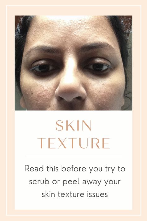 What To Use For Bumpy Skin, Bumpy Skin Texture On Face, How To Even Out Skin Texture, Skin Care For Dry Textured Skin, How To Fix Bumpy Skin, Bumpy Face Remedy, What Helps Textured Skin, Best Products For Skin Texture, Textured Face Remedies