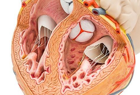 Cardiac (heart) ablation is a minimally invasive procedure that uses radiofrequency energy to destroy small areas of heart tissue that cause irregular heartbeats. Heart Ablation, Ablation Surgery, Heart Structure, Nursing School Prerequisites, Heart Valves, High Cholesterol Levels, Best Nursing Schools, Heart Function, Coronary Arteries