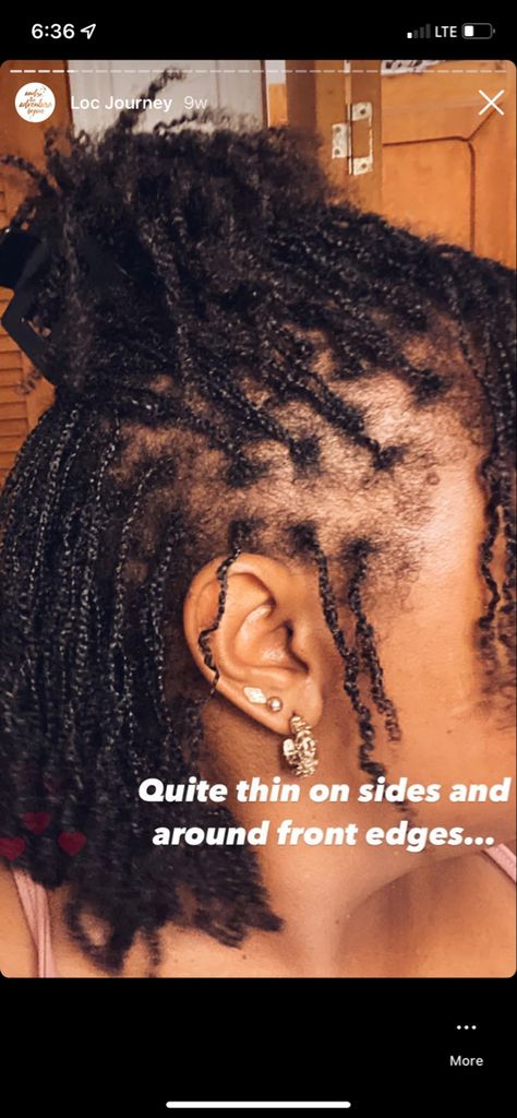 Braid locs/starter locs on natural hair Starter Braid Locs, Starter Locs With Braids, Micro Braid Locs Starter, Braid Starter Locs, Braids Starter Locs, Braid Locs Starter, Micro Braid Locs, Braid Locs, Pink And Black Wallpaper