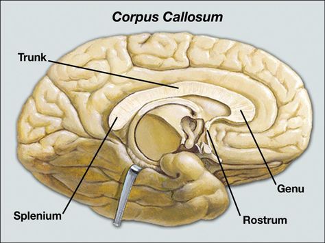 There are four main parts to the corpus callosum. Corpus Callosum, Robert P, Brain Anatomy, Human Body Anatomy, Spinal Cord, Body Anatomy, The Human Body, Head And Neck, Human Body