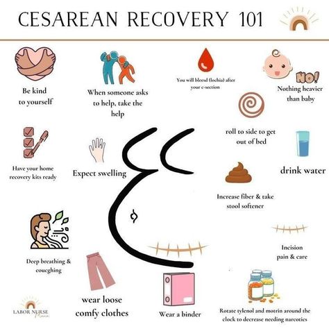 Postpartum Awareness, Postpartum Advice, Cesarean Recovery, Labor Doula, Postpartum Care Kit, Birth Tips, C Section Recovery, Pregnancy Help, Baby Delivery