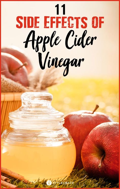 Acv Benefits, Apple Cider Vinegar Remedies, Cider Vinegar Benefits, Vinegar Benefits, Vinegar Rinse, Apple Cider Vinegar Benefits, Apple Cider Vinegar Drink, Apple Vinegar, Cold Sores Remedies