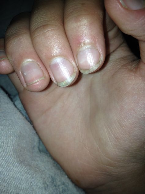 Nail growth 2 weeks sorry thay are dirty Dirty Nails, Essential Oils For Pregnancy, 2023 Nail, Edgy Nails, Nail Growth, Dermatology, Dress Code, Mood Board, Coaching