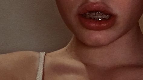 #aesthetic #lips #braces #teeth Teeth Aesthetic Braces, Brace Aesthetics, Teeth Braces Aesthetic, Bunny Teeth Aesthetic, Lips With Braces, Braces Aesthetic Girl, Crooked Teeth Aesthetic, Orthodontics Aesthetic, Aesthetic Braces