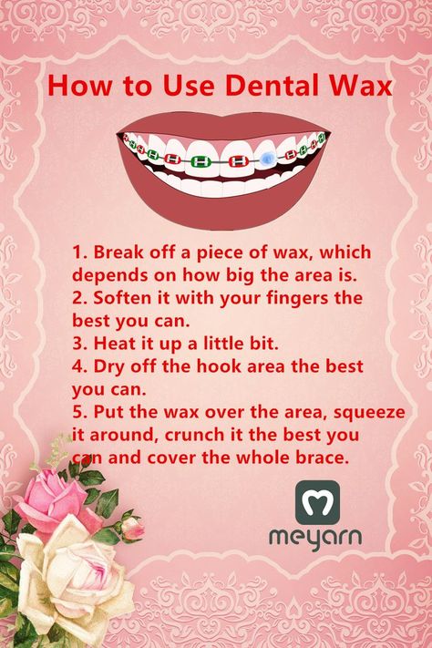 How to Use Dental Wax

1. Break off a piece of wax, which depends on how big the area is.
2. Soften it with your fingers the best you can.
3. Heat it up a little bit.
4. Dry off the hook area the best you can.
5. Put the wax over the area, squeeze it around, crunch it the best you can and cover the whole brace. Braces Colors Combinations, Braces Food, Cute Braces Colors, Braces Tips, Getting Braces, Fruit Recipes Healthy, Cute Braces, Brace Face, Braces Colors