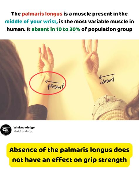 Palmaris Longus, In The Middle, The Middle, Human Body, Human