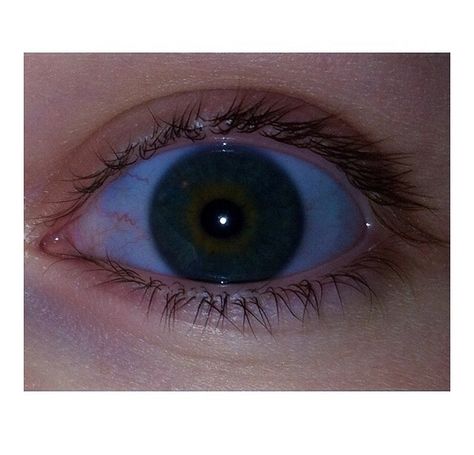 Blue Sclera, Osteogenesis Imperfecta, Monteverde, Eye Health, Royce, Bones, Health, Blue, Beauty