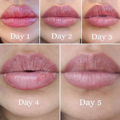 How Long Do Lip Tattoos Take to Heal on Average? Lip Tattoo Healing Process, Lip Blushing Tattoo Healing, Inside Lip Tattoos, Cosmetic Lip Tattoo, Inner Lip Tattoo, Tattoo Healing Process, Lip Healing, Tattoo Healing, Healing Images