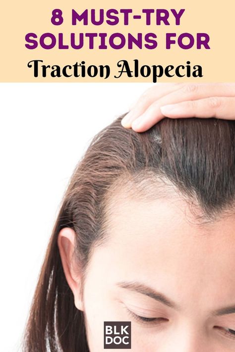 Solutions for Traction Alopecia Traction Alopecia Regrowth, Traction Alopecia Hairstyles, Alopecia Natural Remedies, Tips For Black Women, Black Doctor, Alopecia Hairstyles, Traction Alopecia, Hair Issues, Styling Guide