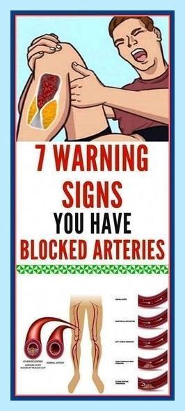 Here Are 7 Warning Signs You Have Blocked Arteries Bad Circulation, Clogged Arteries, Poor Circulation, Women Health, Men's Health, Lose 50 Pounds, Lifestyle Tips, Stubborn Belly Fat, Health And Fitness Tips