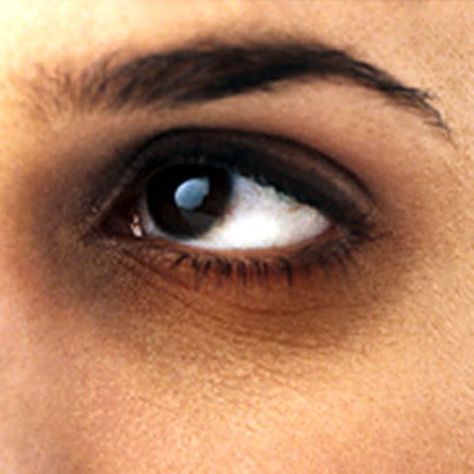 UNDER EYE BAGS AND DARK CIRCLES  If you happen to drink chamomile tea, then do not throw the tea bags after use, store them in the freezer instead. Grate half cucumber and massage it around the eye area. Then place the chilled tea bags on your eyes and lie down for 10 minutes. You will see the difference almost instantly. Clinic Dermatech wants you look your best, always !  ‪#‎10GloriousYears‬ ‪#‎ClinicDermatech‬ ‪#‎LivePowerfully‬ Honey Face Mask, Dark Eye Circles, Remove Dark Circles, Dark Circles Under Eyes, Beauty Tips For Face, Undereye Circles, Dark Eyes, Puffy Eyes, Eye Bags