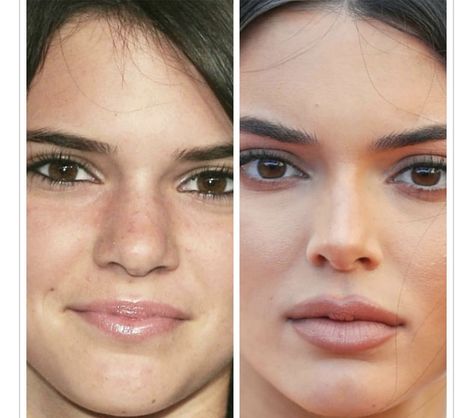 Kendall Jenner Surgery, Kendall Jenner Nose, Kendall Jenner Nose Job, Kendall Jenner Plastic Surgery, Nose Plastic Surgery, Nose Surgery Rhinoplasty, It Makeup, Celebs Without Makeup, Eyebrow Lift