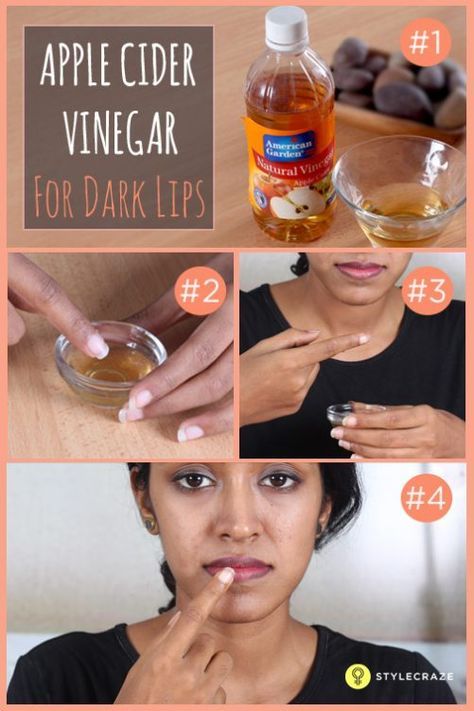 Apple-cider-Vinegar-for-dark-lips Remedies For Dark Lips, For Dark Lips, Lips Aesthetic, Hot Pink Lips, Natural Blush, Baking Soda Shampoo, Diy Lips, That Smile, Dark Lips