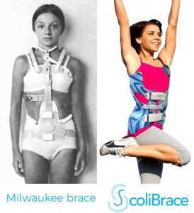 Types Of Braces, Boston Childrens Hospital, Back Brace, Posture Corrector, Childrens Hospital, Lower Back, The View, Workout Programs, Braces