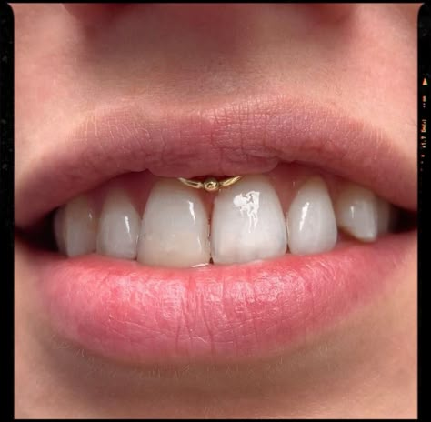 Smiley Piercing - Piercing Idea Smiley Piercing Jewelry Rings, Cute Piercings Face, Smiley Piercing Aesthetic, Smiley Piercing Jewelry, Smiley Piercing Rings, Smile Piercing, Piercing Face, Grillz Teeth, Jewel Tattoo