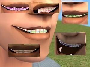 Mod The Sims - A set of 12 Braces :update: with 1 more Braces Cc Sims 4, Sims 4 Cc Teeth Braces Patreon, Sims 4 Cc Braces Teeth, Braces Sims 4 Cc, Sims 4 Braces Cc, Sims 4 Cc Braces, Sims 4 Braces, Teeth Braces, Full Face Makeup