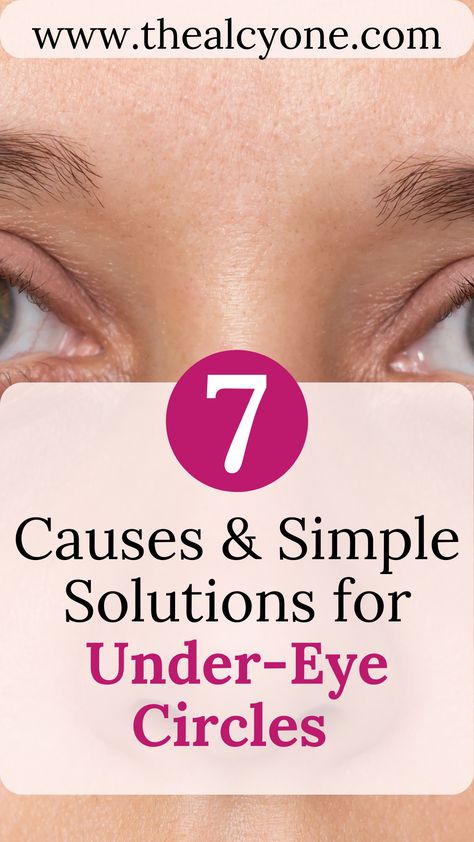 Say farewell to under-eye bags and dark circles! Our guide breaks down the top 7 causes and provides easy-to-follow tips on how to lighten and reduce them for good. Discover the secrets to a refreshed, radiant appearance. Under Eye Puffiness, Under Eye Bags, Undereye Circles, Effective Skin Care Products, Tired Eyes, Eye Bags, Bright Eyes, Eye Cream, Dark Circles