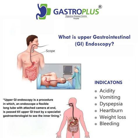 "What is upper Gastrointestinal (GI) Endoscopy? Upper GI endoscopy is a procedure in which, an endoscope a flexible long tube with attached camera at end, is passed till upper GI tract by a specialist gastroenterologist to see the inner lining." Gi Tract, Disease, Quick Saves