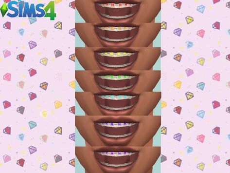 Sims 4 Braces Mod, Sims4 Braces Cc, Sims 4 Cc Braces Patreon, Sims 4 Colored Braces, Sims Braces Cc, The Sims 4 Cc Braces, Sims4 Braces, Sims 4 Braces Teeth, Braces Cc Sims 4