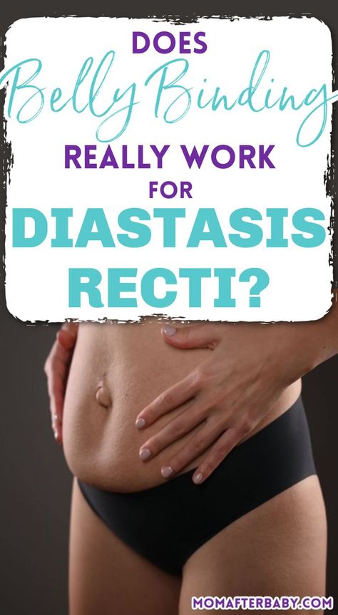 Find out if the popular "belly binding" trick really helps moms with diastasis recti get their core back after birth. Plus, understand exactly what postpartum diastasis recti is! Belly Binding After Baby, Postpartum Belly Binding, Belly Binding Postpartum, Binding Ideas, Belly Binding, Healing Diastasis Recti, Tummy Wrap, Mom Belly, Belly Wrap