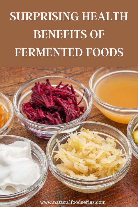 Fermented Foods health benefits includes boosting immune system, maintaining healthy intestine, strengthening bones, supporting weight loss, a good source of fiber, increasing body energy, maintaining cholesterol level, ideal for diabetics, a source of antioxidants, contains probiotics. #fermentedfoods #fermentedfoodsbenefits #fermentedfoodsuses Good Food Habits, Benefits Of Fermented Foods, Probiotic Food, Fermented Foods Benefits, Raw Cheese, Fermenting Weights, Intestinal Health, Food Health Benefits, Source Of Fiber