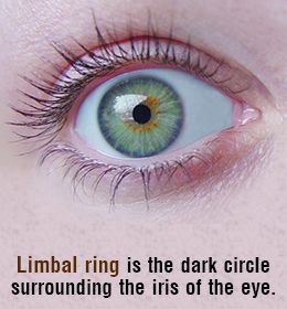 Limbal rings reduce as we age Limbal Ring, Ring Meaning, Dark Ring, Rings With Meaning, Dark Rings, Normal Guys, Dark Circles, Anatomy, Fun Facts