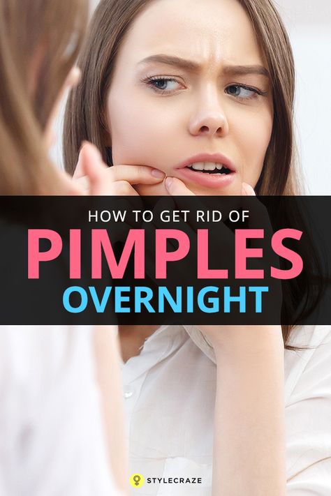 Get Rid Of Pimples Overnight, Rid Of Pimples Overnight, Chest Acne, Get Rid Of Pimples, Rid Of Pimples, Forehead Acne, Acne Overnight, Pimples Overnight, Skin Care Routine For 20s