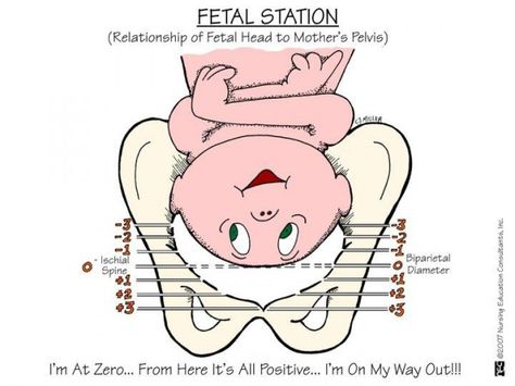 Most women only tend to care about how far they’ve dilated when they’re in labor.  But there is a bit more involved with your body and baby’s placement when it comes to everything that’s going on. Nursing Tools, Newborn Nursing, Nursing Information, Child Nursing, Nursing Board, Nursing Mnemonics, Ob Nursing, Nursing School Survival, Nursing School Studying