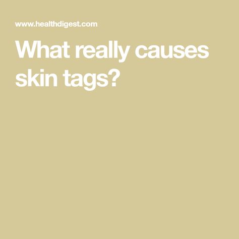 What really causes skin tags? Skin Tags What Causes, Causes Of Skin Tags, Skin Growths, Skin Tags, Family Medicine, After Pregnancy, New Skin, Smooth Skin, Show Up