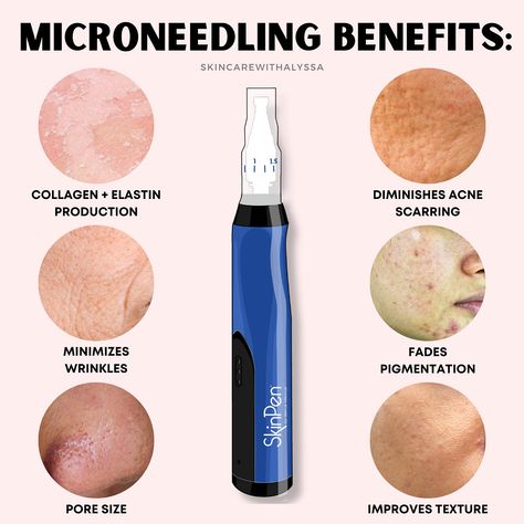 With the SkinPen Micro Needling, Microneedling Aesthetic, Microneedling Benefits, Rf Microneedling, Microneedling Depth Chart, Microneedling Post Care, Benefits Of Microneedling, Skin Pen Microneedling, Skinpen Microneedling