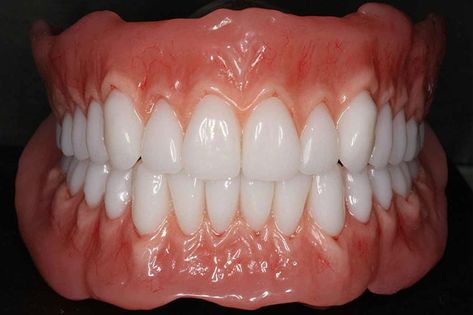 Partial Dentures, Loose Tooth, Human Teeth, Oil Pulling, Perfect Smile, Dentures, Anatomy Reference, White Teeth, Brisbane