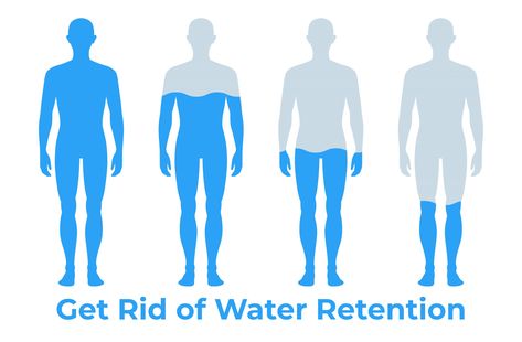 How to Get Rid Of Water Retention Fluid Retention Remedies, Water Retention Causes, Sweet Sweat Waist Trimmer, Water Retention Remedies, Lose Water Weight, Retaining Water, Sweet Sweat, Swollen Legs, Fat Burning Supplements