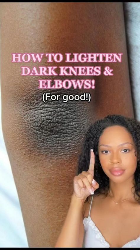 Dark Knees, Haut Routine, Skin Advice, Natural Face Skin Care, Serious Skin Care, Women Hairstyles Medium, Basic Skin Care Routine, Clear Skin Tips, Healthy Skin Tips