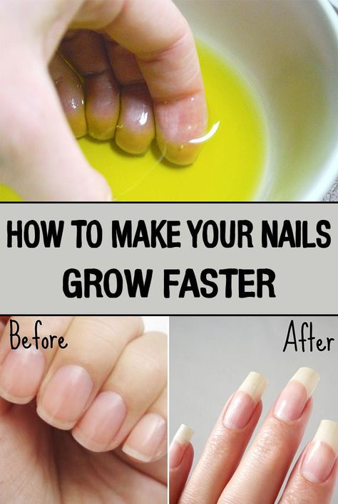 How to grow our nail faster in 2023 Nails Grow Faster, Make Nails Grow, Do It Yourself Nails, Longer Nails, Nail Room Ideas, Grow Nails Faster, Fast Nail, Nail Care Tips, How To Grow Nails