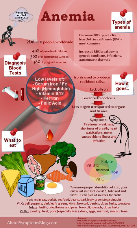 Iron Deficiency Anemia - symptoms and solutions Infographic Fat Burning Meal Plan, Foods With Iron, Quick Diet, Iron Deficiency, Iron Rich Foods, Health Matters, Health Info, Health Remedies, Healthy Weight