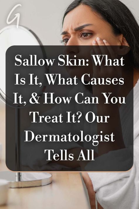 It's natural for skin to change color or integrity throughout one's life, but certain shifts in your complexion can be challenging to treat — and this includes sallow skin. #dullskin #skin #care #skincare #perfect #skin Sallow Skin, Lifestyle Habits, Alpha Hydroxy Acid, Sleep Deprivation, Perfect Skin, One Life, Dull Skin, Dermatology, Health Professionals