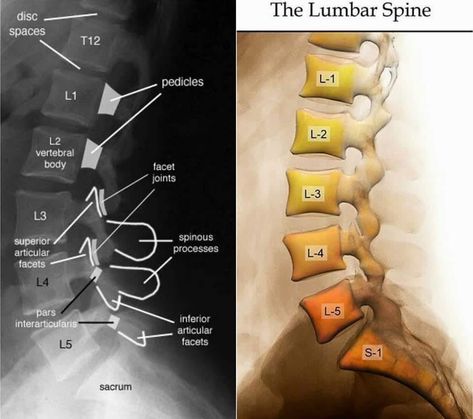 Radiography Student, Radiology Schools, Medical Radiography, Radiology Student, Radiology Technician, Radiology Imaging, Anatomy Bones, Med Surg Nursing, Human Body Organs